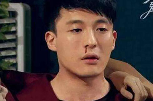 ����Ѫ��ʲôԭ�� ����Ѫ��������